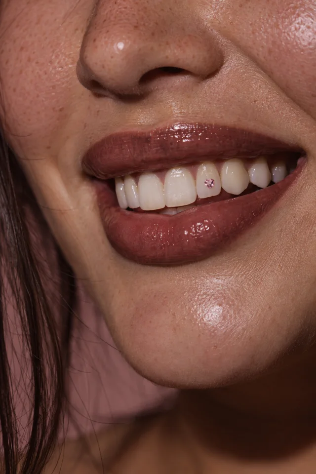Inspiration IA : strass cœur rose sur une incisive