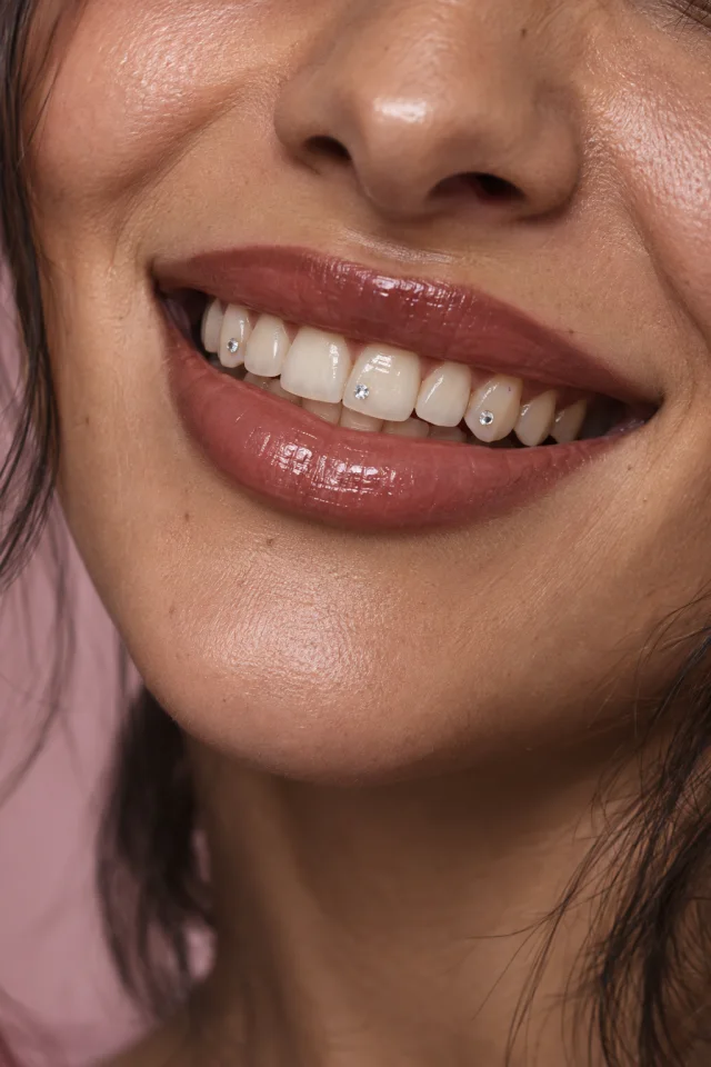 Inspiration IA : trois strass ronds sur trois dents